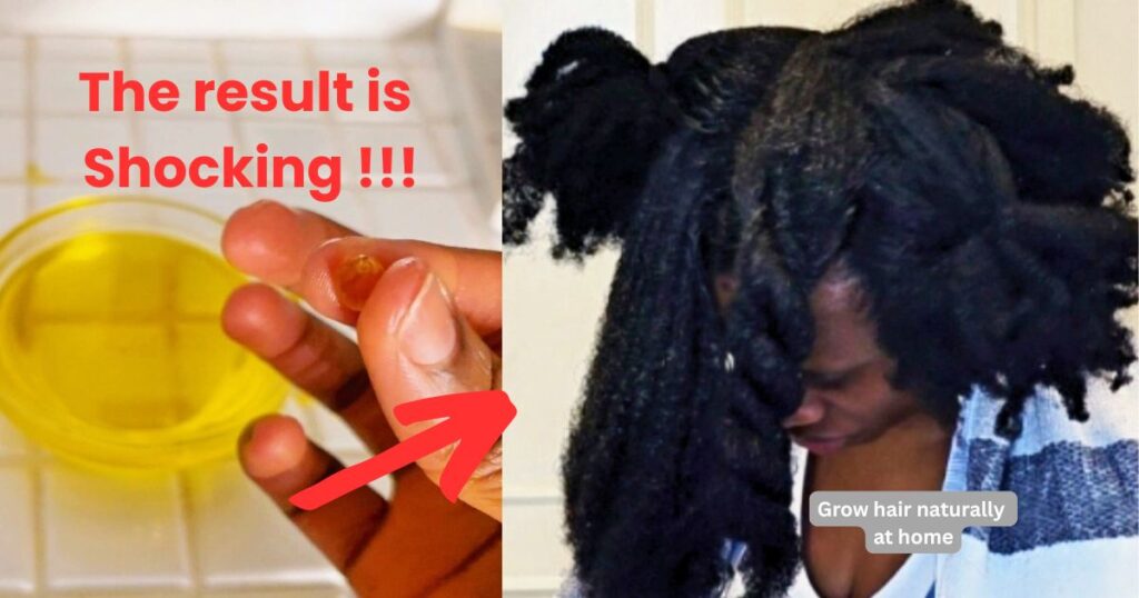 hair speed and scalp growth with this homemade hair oil